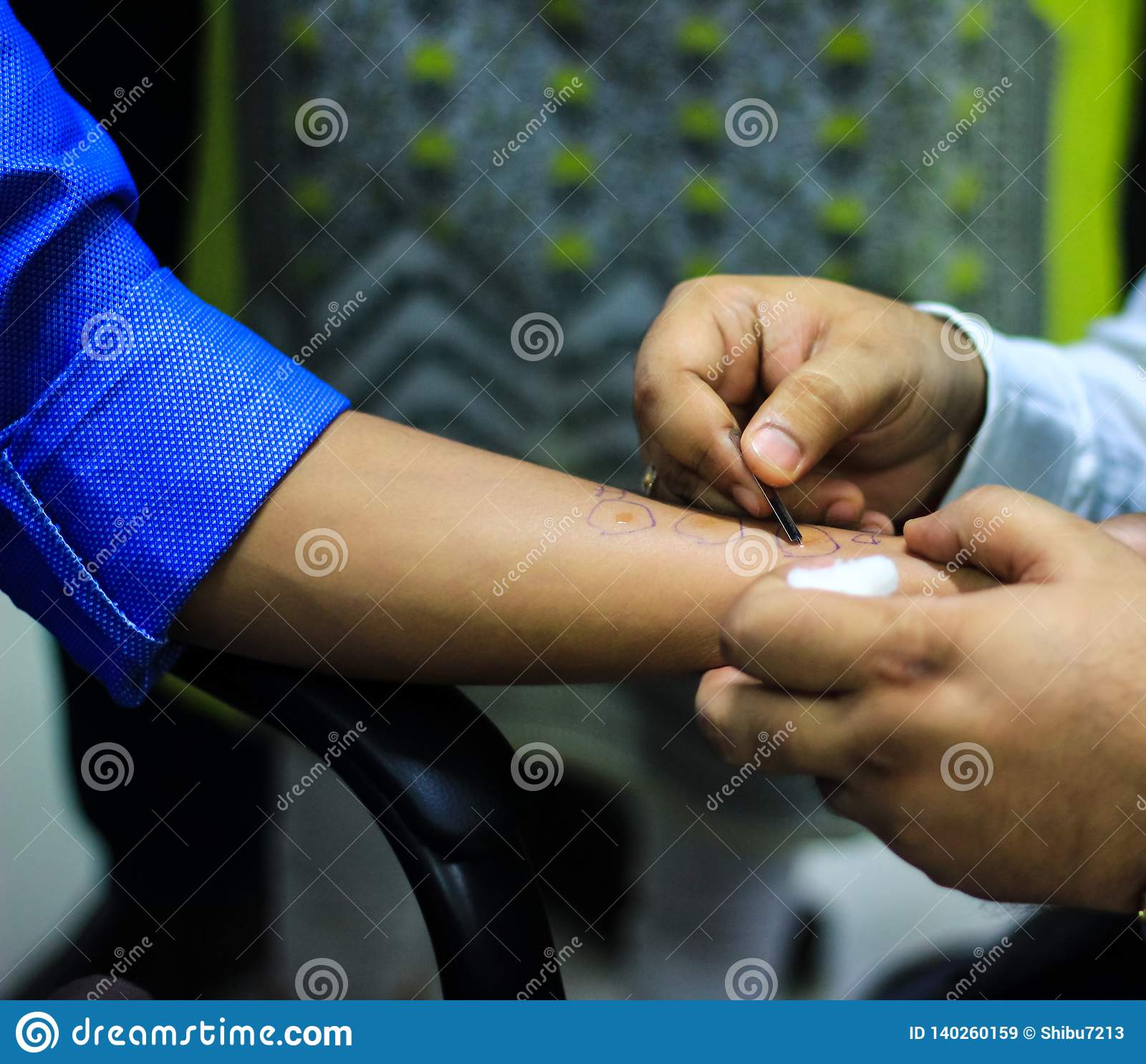 Skin Allergy Test Preparation By Doctor On A Patient Hand Using Lancet ...