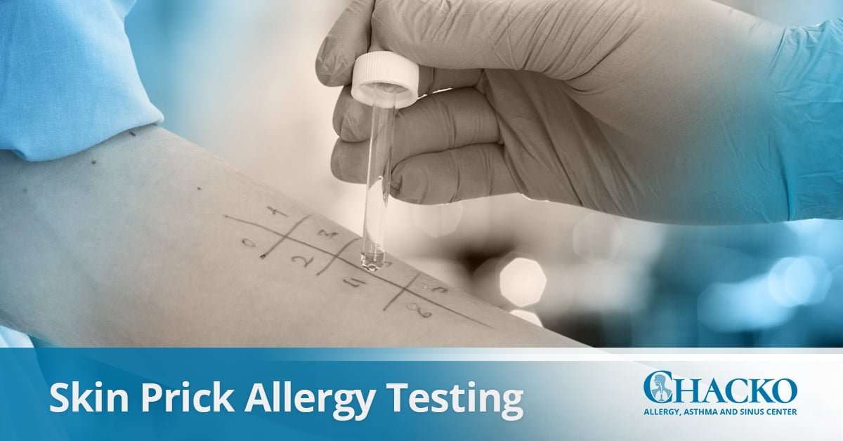 Skin Prick Allergy Testing in Atlanta