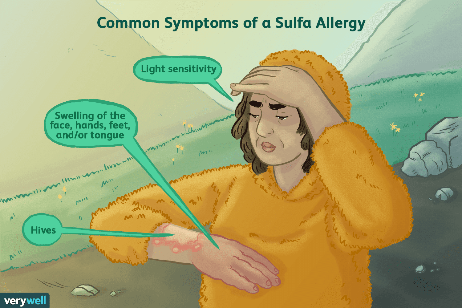Sulfa Allergy: Symptoms, Causes, Diagnosis, and Treatment
