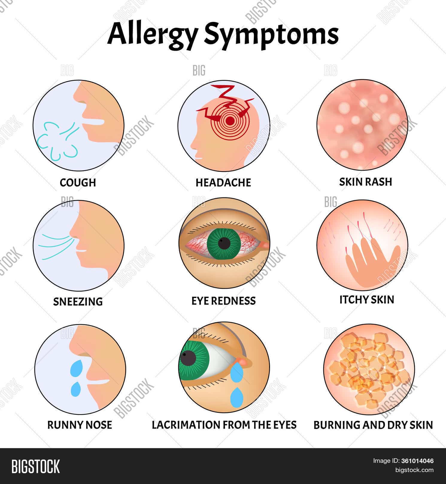 Symptoms Allergies Image &  Photo (Free Trial)