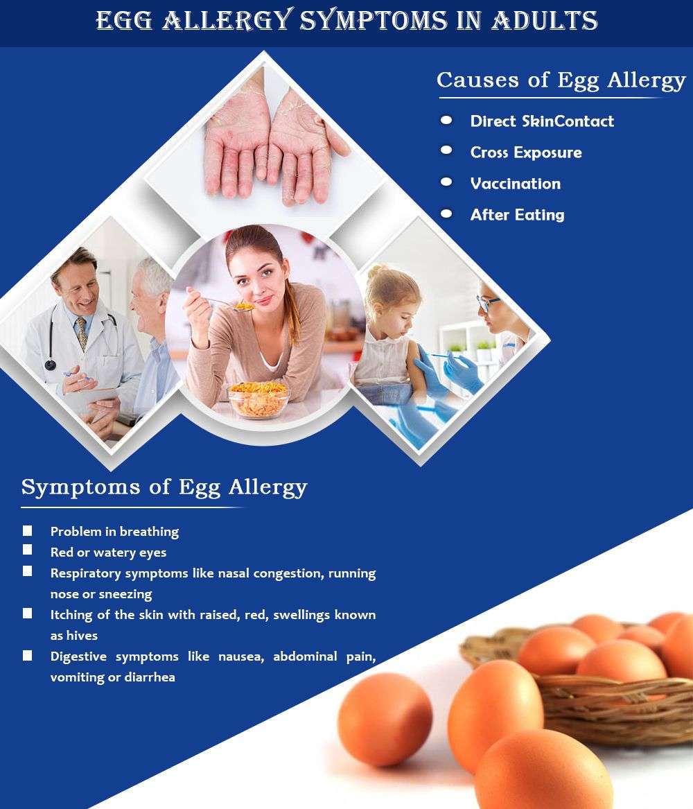 Symptoms &  Causes of Egg Allergy In Children And Adults ...
