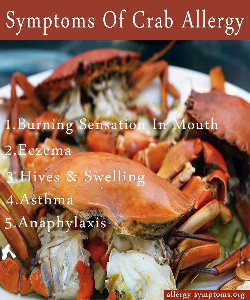 Symptoms of Crab Allergy
