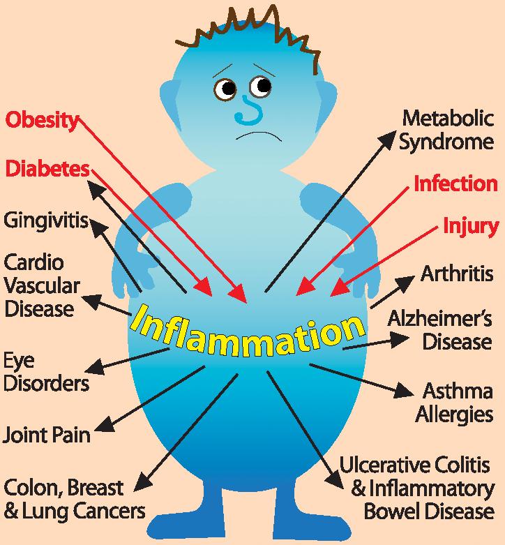 The 11 Factors that Cause Inflammation