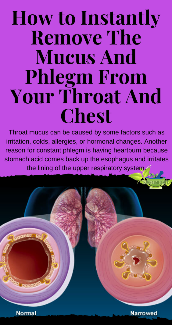 Throat mucus can be caused by some factors such as ...