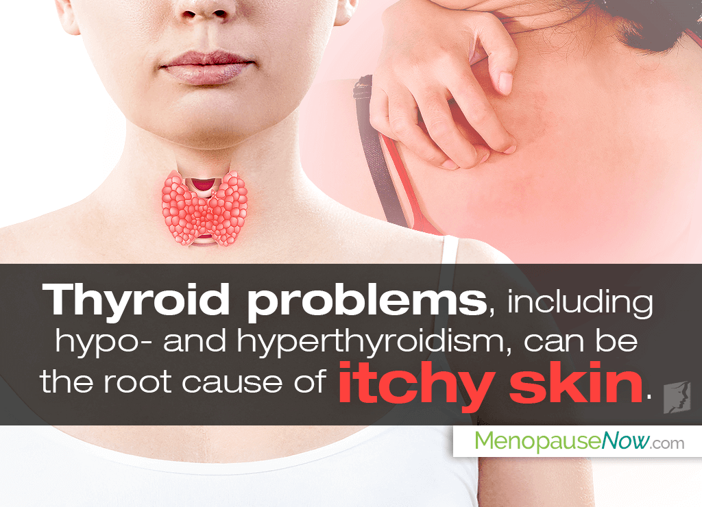 Thyroid and Itchy Skin: The Link