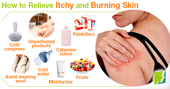 Tips to Relieve Itchy and Burning Skin