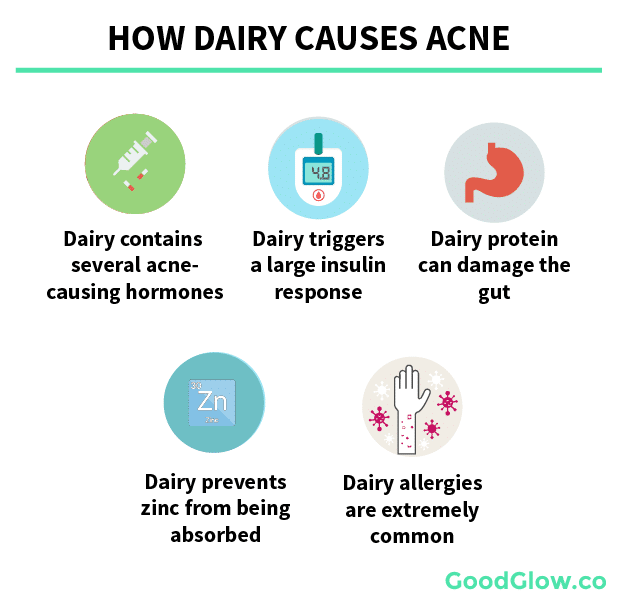 Top 4 Best Milk Alternatives for Acne Prone Skin: A Detailed Analysis ...