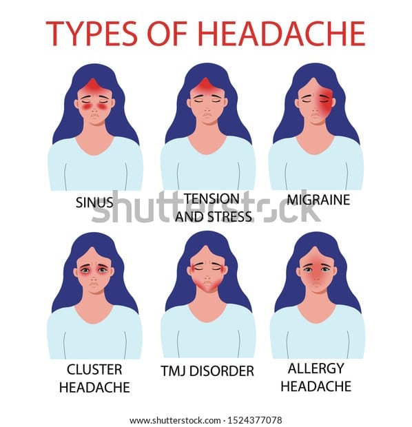 Types Headache Allergy Tmj Temporomandibular Joint Stock Vector ...