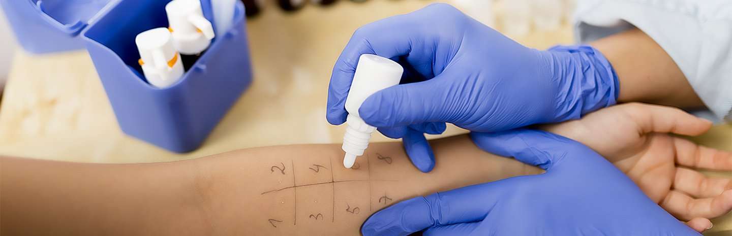 What Allergy Tests Do You Need?
