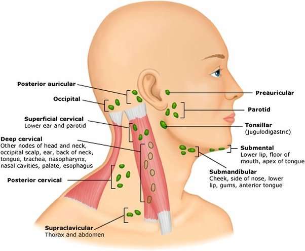 What causes jaw pain and swollen lymph nodes?