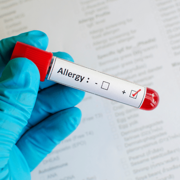 What is Allergy Skin Testing?