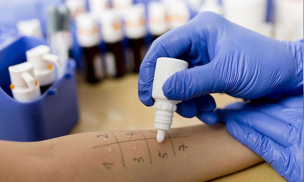 What is Allergy Testing all about?: AIR Care: Asthma, Allergy, and ...