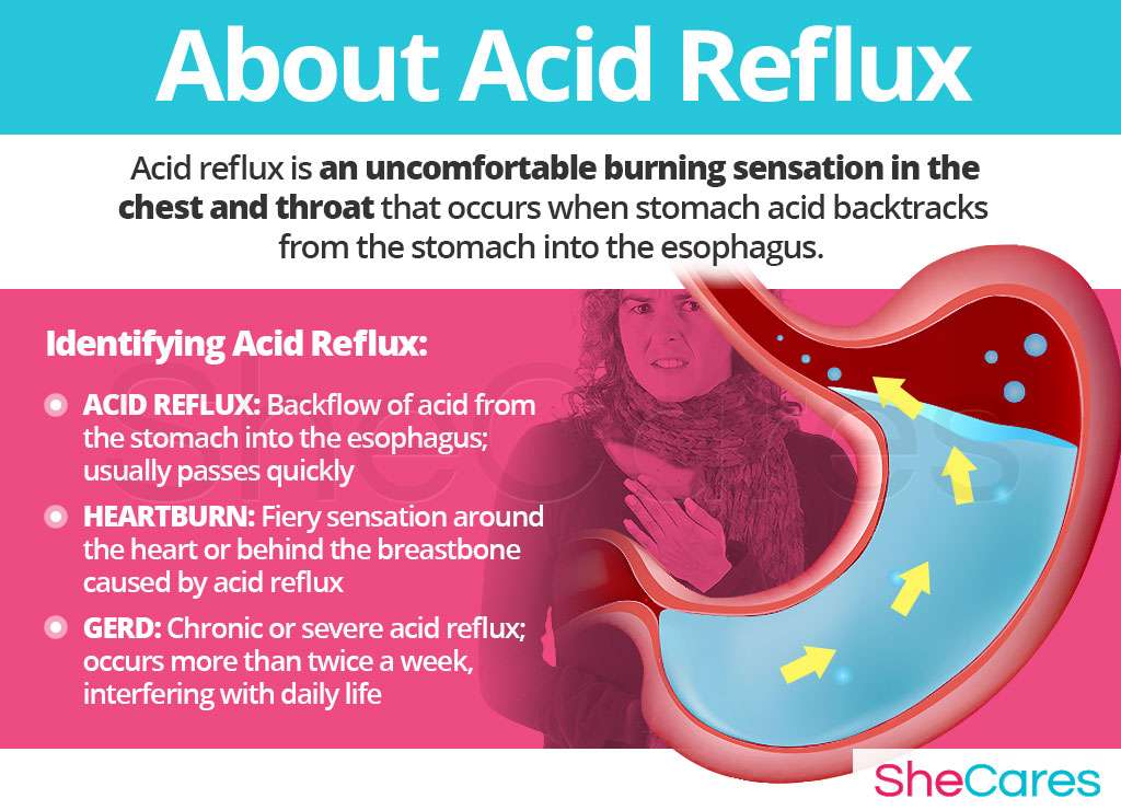 What Is Chronic Acid Reflux