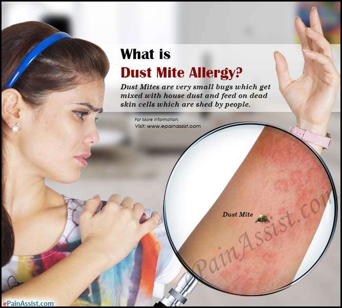 What is Dust Mite Allergy