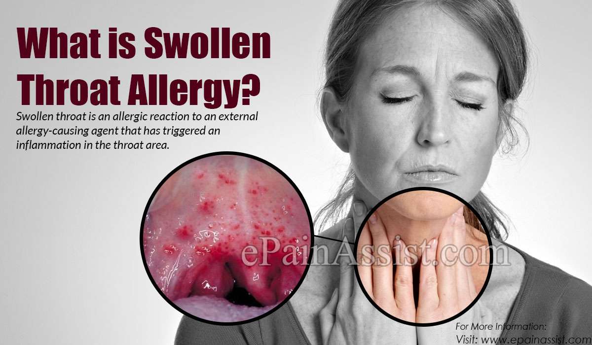 What is Swollen Throat Allergy &  How is it Treated?