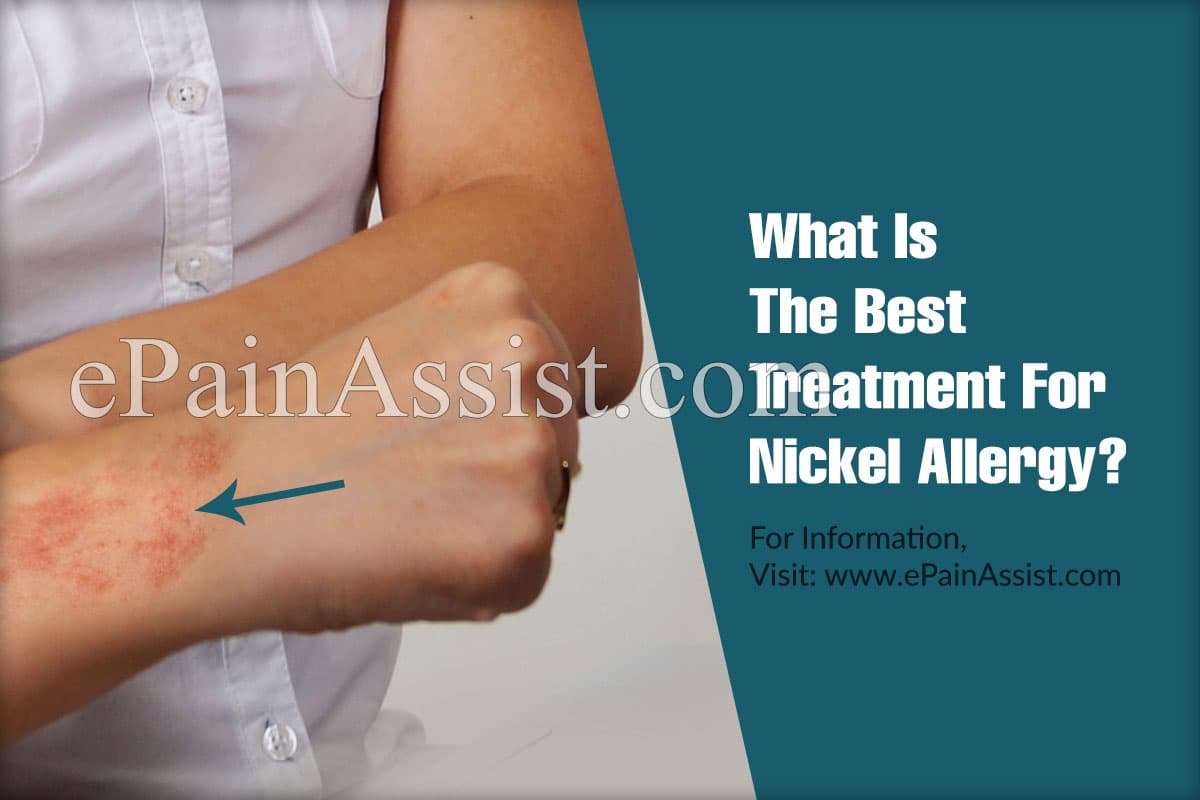 What Is The Best Treatment For Nickel Allergy?