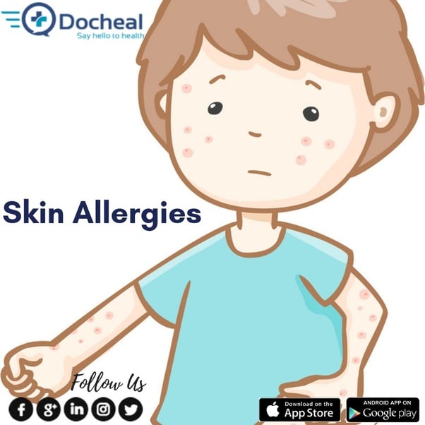 What kind of doctor treats skin allergies?