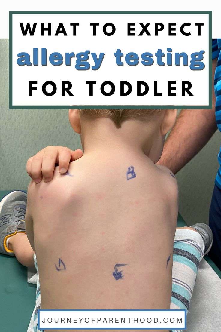 What to Expect: Allergy Testing for Toddler. Have a child with ...