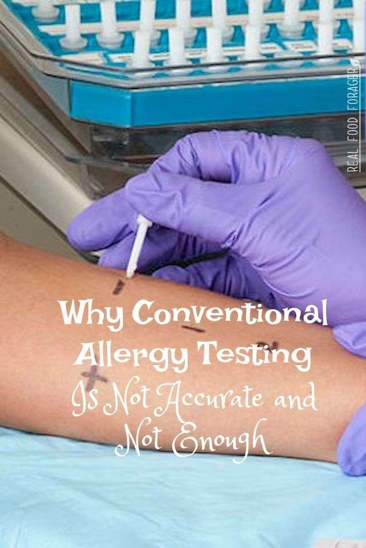 Why Conventional Allergy Testing Is Not Accurate and Not ...