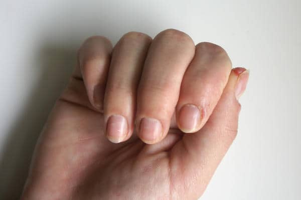 Why Do Acrylic Nails Hurt: 4 Reasons  NailDesignCode