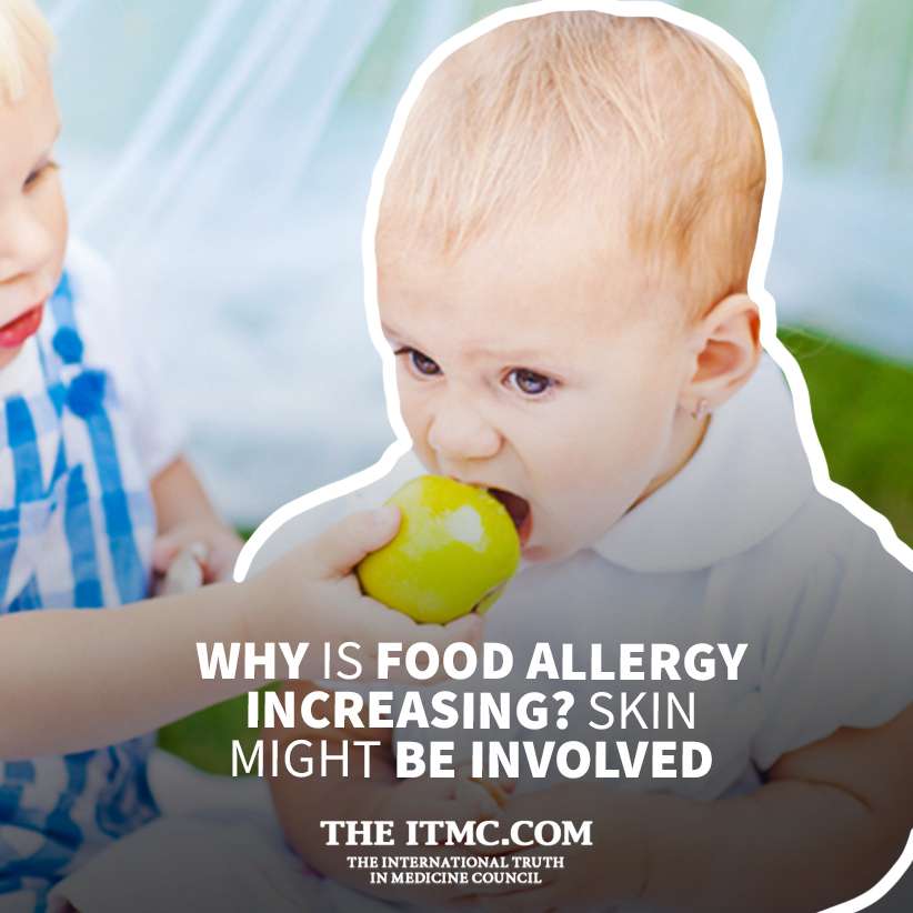 Why is food allergy increasing? Skin might be involved
