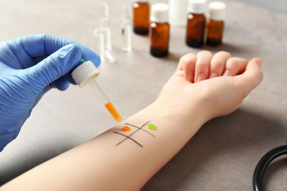Why Skin Testing Is Important to Really Understand Your ...