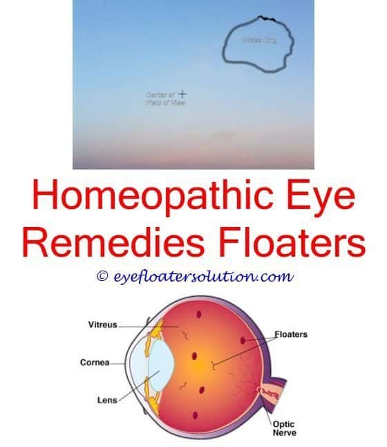 will eye floaters go away on their own