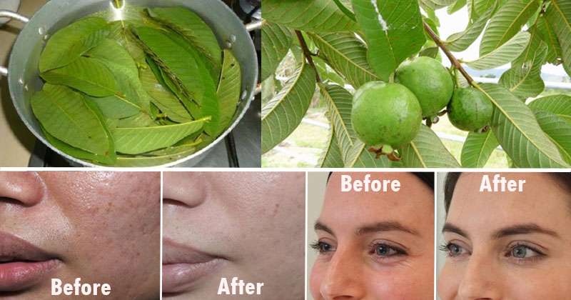 Wonder Fruits, Plants and Seeds: Ways to use Guava leaves to help get ...