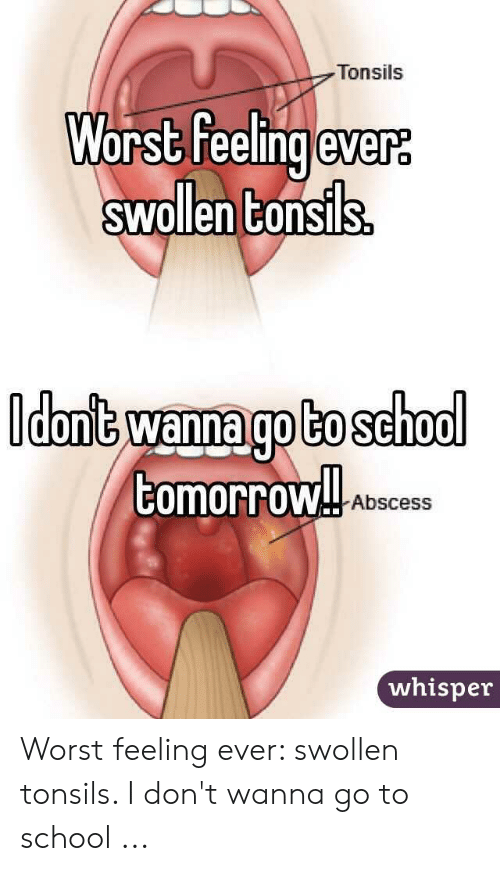 ð¥ 25+ Best Memes About Swollen Tonsils